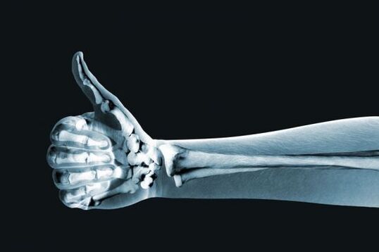 Рендген за дијагнозу болова у зглобовима прстију